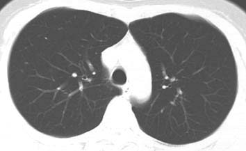 ����x��CT