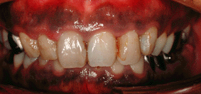 30�㏗���i����18�N