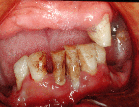 60��j���@�i����30�N