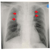 �x����̃����g�Q���ʐ^