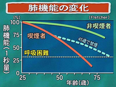 �x�@�\������r�Ȑ��O���t