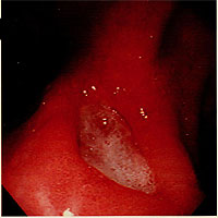 �}���ݒ�ᇂ̓���������