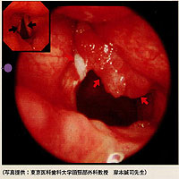 �������̓������ʐ^