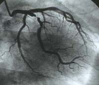 ���������e�̃t�B����