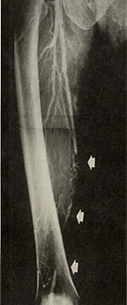 �ʐ^1)�����������e��67�˒j��