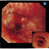 �x����̋C�ǎx������