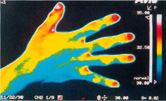 ��̃T�[���O���t�B�[�O