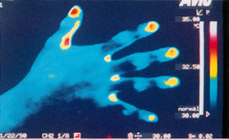 ��̃T�[���O���t�B�[��