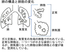 �x�̍\���Ɣx�E�̕ω�